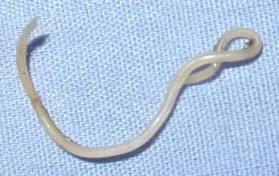 roundworms in dogs